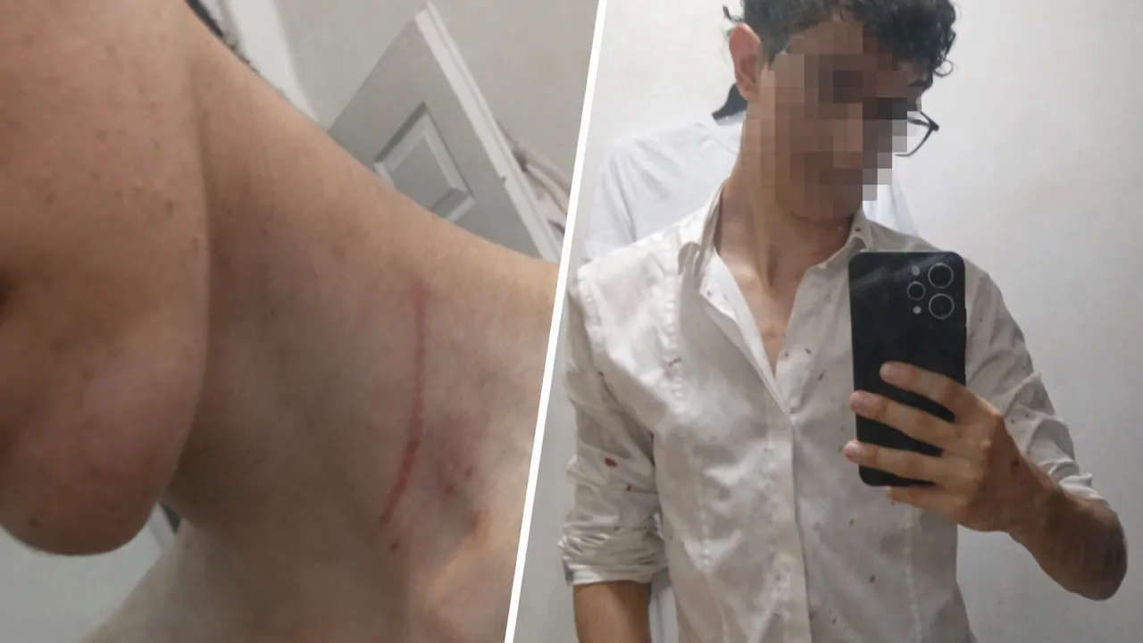 Okul dönüşü dehşet! 16 yaşındaki genç magandaların hedefi oldu