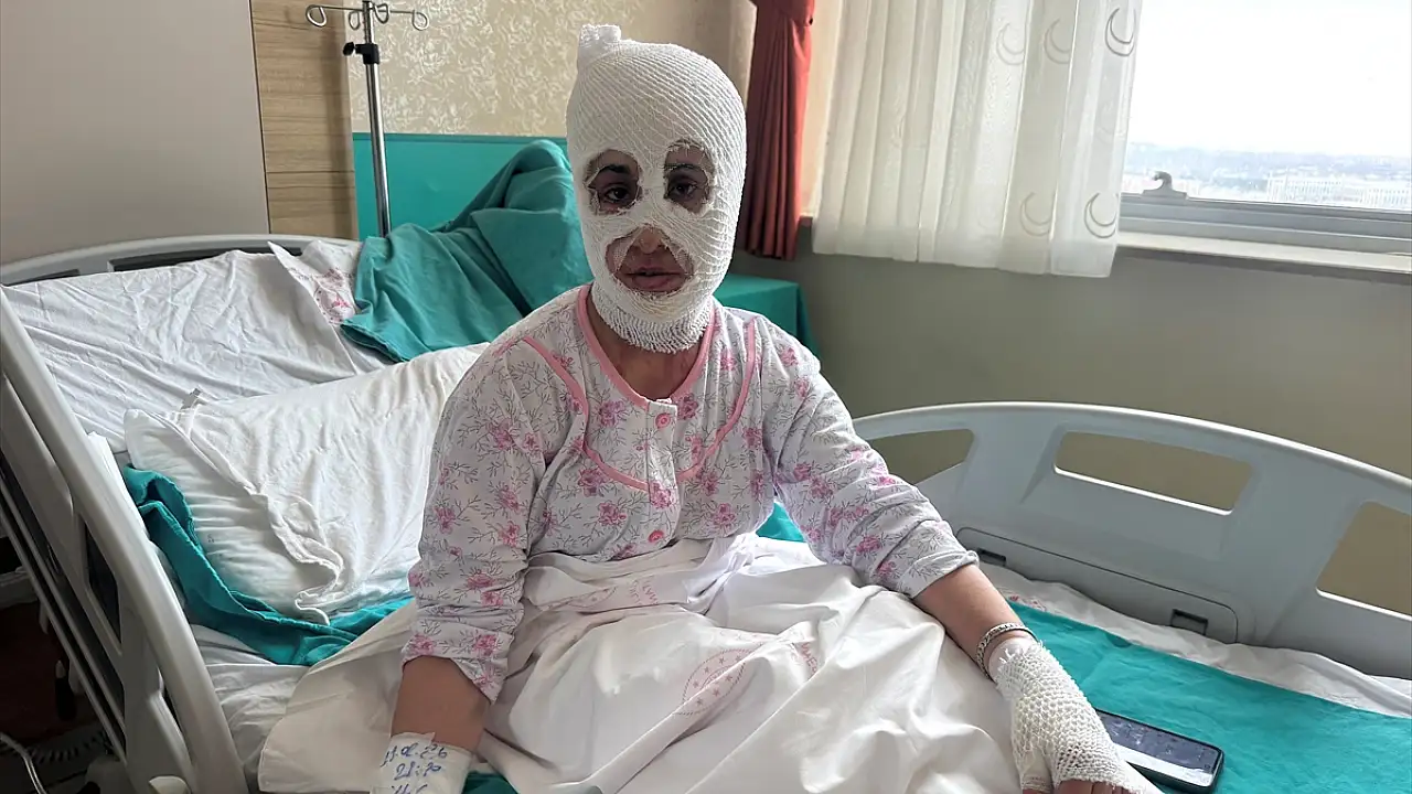 Ağrı’da Düdüklü Tencere Patlaması: Genç Anne Yanıklarla Hayatta Kaldı