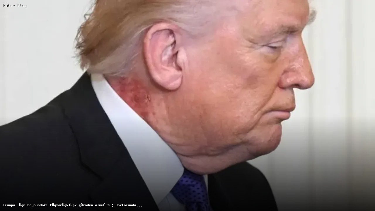 Trump’ın Boynundaki Kızarıklığın Ardındaki Gerçekler