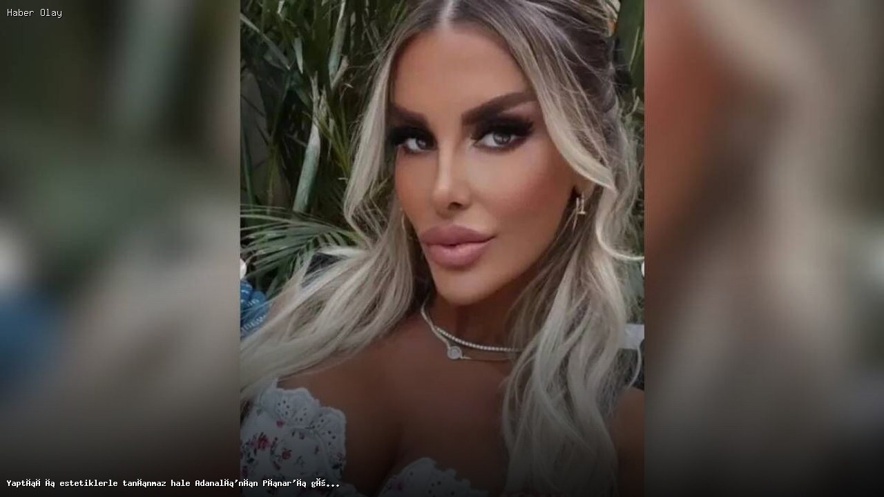 Estetik Değişimle Gündeme Gelen Pınar Kimdir?