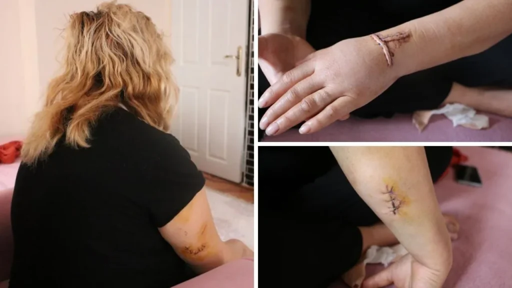 Diyarbakır’da Dini Nikahlı Eşini 30 Yerinden Bıçakladı