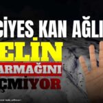 Erciyes Kayak Merkezi’nde Sezon Sonu Yaklaşırken Hava Durumu Ne Olacak?