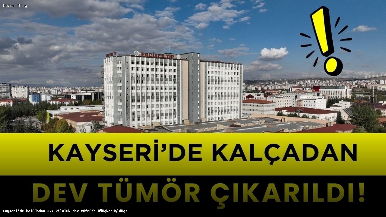 Kayseri’de Kalçadan Çıkarılan Dev Tümörün Hikayesi